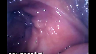Girl cums filmed from inside a vagina at secretfriends com