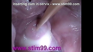 Outsert sperm cum wide cervix wide dilatation pussy send back