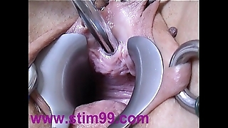 Peehole move having it away urethral sound insertion dilatation